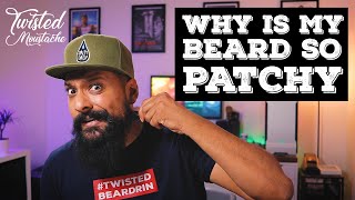 My Beard Is Patchy How To Deal With Patchy Beard Growth [upl. by Savannah]