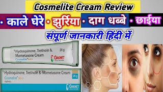 Cosmelite cream uses amp side effects  Cosmelite Cream ke fayde  Cosmelite Cream full review Hindi [upl. by Ventura]