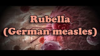 Rubella German measles  الحصبة الألمانية [upl. by Boice300]