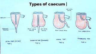 Types of caecum  med tutorials [upl. by Nobie]