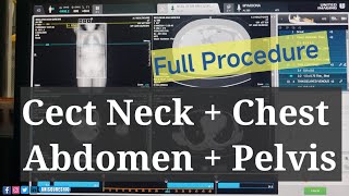 Cect Neck Chest Abdomen amp Pelvis  Timing amp FOV By Anis Qureshi [upl. by Hamilah]