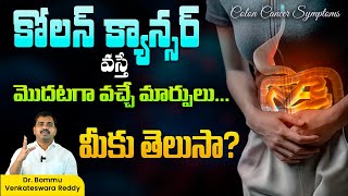 పెద్దప్రేగు క్యాన్సర్ వస్తే మీలో మొదటగా వచ్చే మార్పులు మీకు తెలుసా  Colon Cancer Symptoms  Colon [upl. by Gottwald995]