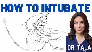 Neonatal intubation made SUPER EASY Stepbystep instructions [upl. by Anaitat]