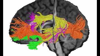 Dorsal and Ventral Language Streams in the Brain [upl. by Schnur]