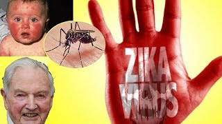 5 Datos Aterradores Sobre el Virus ZIKA [upl. by Nemhauser409]