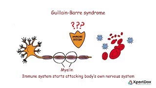 Guillain Barre Syndrome  Where bodys immune system attacks its nervous system [upl. by Gifferd]