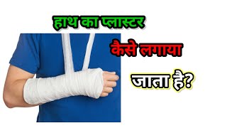 How to Apply POP COST FOR WRIST JOINT [upl. by Aissenav555]