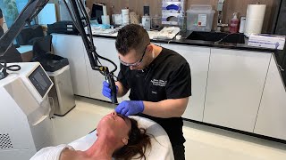 Ablative Erbium Laser for Skin Resurfacing  West Hollywood CA  Dr Jason Emer [upl. by Gladis765]