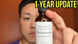 THIS IS WHAT HAPPENED AFTER TAKING PYRILUTAMIDE FOR 1 YEAR [upl. by Allissa]