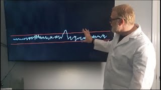 What do Limit of Detection and Limit of Quantitation mean [upl. by Liz]