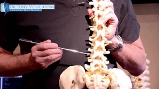 Spinal Pain Mapping  Back Pain After Car Accident Case Study by DrTony Mork [upl. by Nesyaj606]