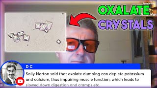 Oxalate dumping causing cramps amp slowed digestion  HarrySerpanos [upl. by Mohun233]