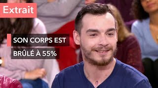 Grand brûlé  il a été enseveli par 7 tonnes de goudron à 150°C  Ça commence aujourdhui [upl. by Ajat238]