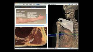 Cadaver Dissection Guide Overview [upl. by Lairea]