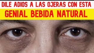 🔴✅ Por Fin Como Eliminar Las Ojeras Hereditarias  Remedio Para Quitar Ojeras Rapido [upl. by Niaz]