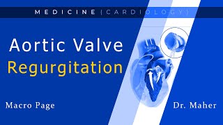 Aortic Regurgitation  With mnemonics   Valvular Heart Disease 3 [upl. by Artened]