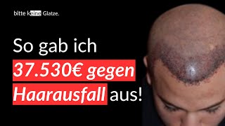 16 Jahre Haarausfall und 37000€ später Meine haarausfall und haartransplantation Geschichte [upl. by Naillimxam]