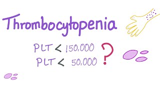 Thrombocytopenia  Why Is My Platelet Count Low [upl. by Korrie57]