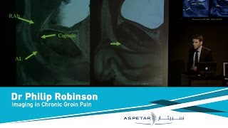 Imaging in Chronic Groin Pain by Dr Philip Robinson [upl. by Timus]