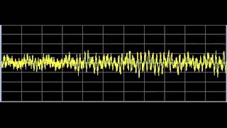 Cancer PreLeukemia and Leukemia Rife Frequencies [upl. by Eisnyl403]