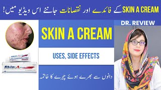 Dr Reviewed SKIN A CREAM  Uses  Side Effects  Tretinoin Cream  Beauty Facts  UrduHindi [upl. by Soracco]