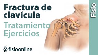 FRACTURA de CLAVÍCULA Rehabilitación ejercicios y tiempo de RECUPERACIÓN [upl. by Anyd]