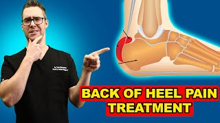 Retrocalcaneal Heel Bursitis Pain in the back of the Heel TREATMENT [upl. by Anadal]