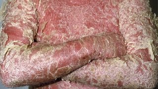 Erythrodermic psoriasis images photos pictures erythroderma symptoms [upl. by Hatti]