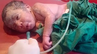 New born baby came with abnormal condition syanose syptoms take action suction done lookthe baby 🥰❣️ [upl. by Anrapa353]