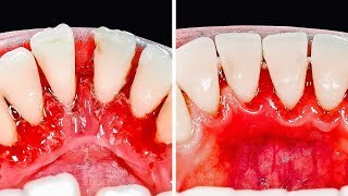 30 ASTUCES POUR LES DENTS QUE TU DOIS CONNAÎTRE [upl. by Arlana548]