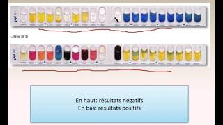 Comment reconnaître la positivité des puits sur le test de l API 20E foryou analyse pourtoi [upl. by Breed]