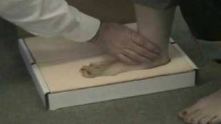 How to Use a Foam Impression Box for Fitting Custom Insoles  MMAR Medical [upl. by Nylassej]