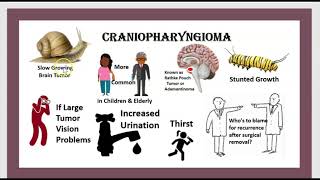 Tumeur Hypophysaire Craniopharyngiome Chirurgie Endoscopique Cérébrale Poche de Rathke 3 minutes [upl. by Afrika]