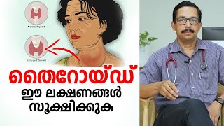 തൈറോയ്ഡ് ഈ രോഗ ലക്ഷണങ്ങൾ സൂക്ഷിക്കുക  Thyroid Malayalam Health Tips [upl. by Ahsemal]