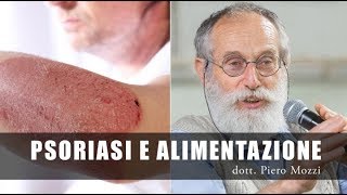 Dott Mozzi Curare la Psoriasi con la dieta [upl. by Enyaz]