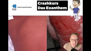 KSB Dermatologie Kurs 4 das Exanthem [upl. by Thevenot]