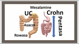 Maladie de Crohn Rectocolite hémorragique RCH Causes Symptômes Traitement Régime Mesalamine Pentasa [upl. by Eitisahc]