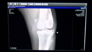 Dog with Torn ACL in Left Knee  High Desert Veterinary [upl. by Zetnahs323]