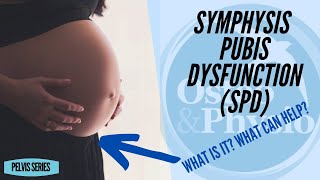 SYMPHYSIS PUBIS DYSFUNCTION SPD [upl. by Biddie]