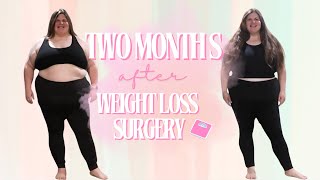 2 Months After Weight Loss Surgery  Weight Loss Progress update [upl. by Sylram407]