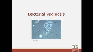 Non Infectious and Recurrent Vulvovaginitis Etiology Epidemiology Diagnosis amp Treatment [upl. by Byrdie651]