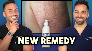 Keratosis Pilaris Crepey Skin New Product Alert from Remedy Science 🚨 [upl. by Enylorac]