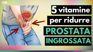 5 migliori VITAMINE per ridurre la PROSTATA ingrossata [upl. by Elkin]