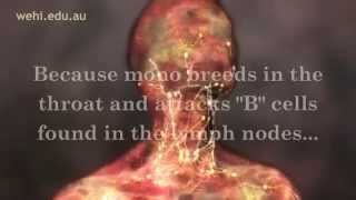 Symptoms of Mono  Mono Symptoms  Infectious Mononucleosis Disease [upl. by Archangel]