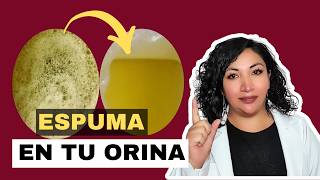 ELIMINA la espuma de tu orina porque tu orina tiene espuma 😨 [upl. by Onimod183]