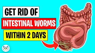 Use These Natural Methods To Get Rid of Intestinal Worms Within Two Days [upl. by Aiykan]