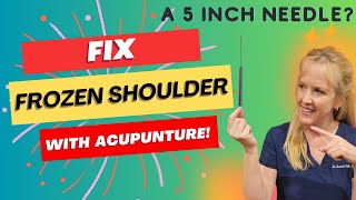 FIX Frozen Shoulder with Acupuncture [upl. by Namus]