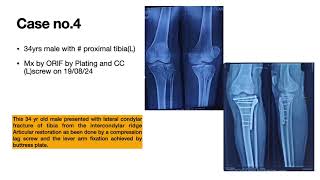 ORTHOPEDIC OPERATIONS PIMS AUGUST 2024 [upl. by Sheets162]