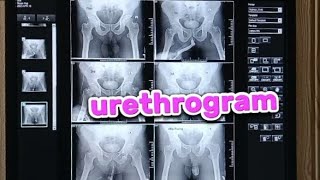 How i prepare urethrogram x ray  x ray urethrogram taking and filming [upl. by Werdnael]