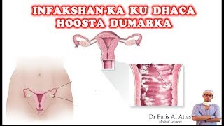 INFAKSHANKA KU DHACA XUBINKA TARANKA DUMARKA IYO SIDA LOO DAAWEEYO Dr faris [upl. by Ainat]